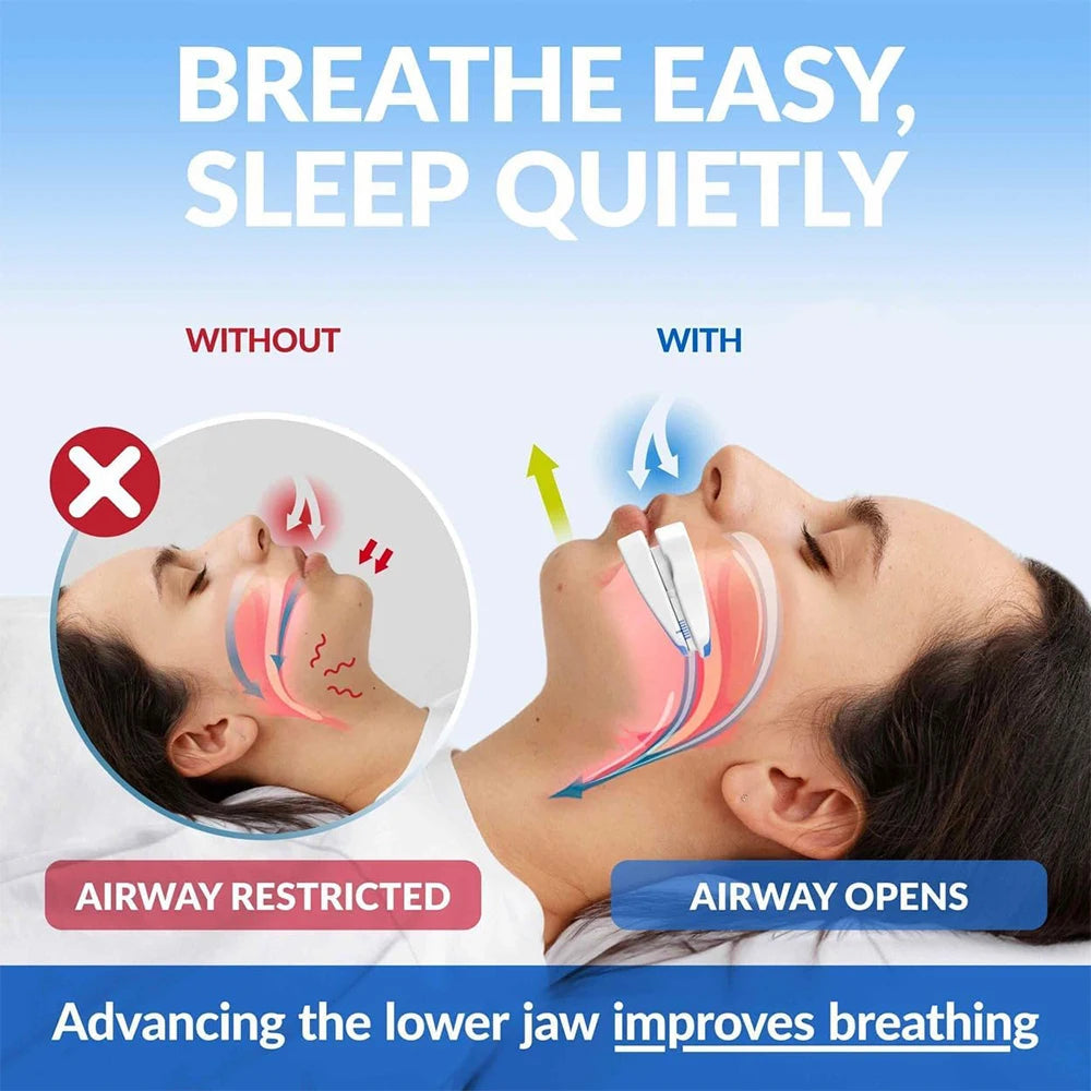 Gouttière Anti-Ronflement Ajustable – Protège Dents Nuit & Bien-Être Sommeil Shopgohealthy